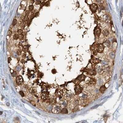 Immunohistochemistry-Paraffin: p23/PTGES3 Antibody [NBP1-85485]