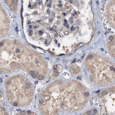 Immunohistochemistry-Paraffin: p23/PTGES3 Antibody [NBP1-85485]