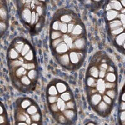 Immunohistochemistry-Paraffin: p23/PTGES3 Antibody [NBP1-85485]