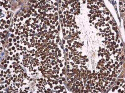 Immunohistochemistry-Paraffin: p23/PTGES3 Antibody [NBP2-19998]
