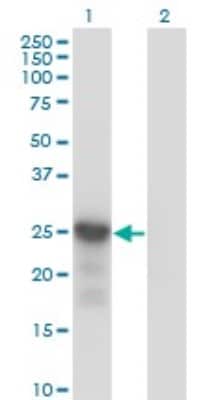 Western Blot: p27/Kip1 Antibody (4B4-E6) [H00001027-M01]