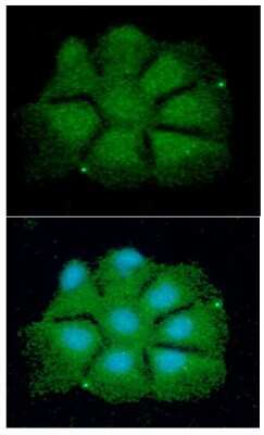 Immunocytochemistry/ Immunofluorescence: p27/Kip1 Antibody (7B9) - BSA Free [NBP2-59444]