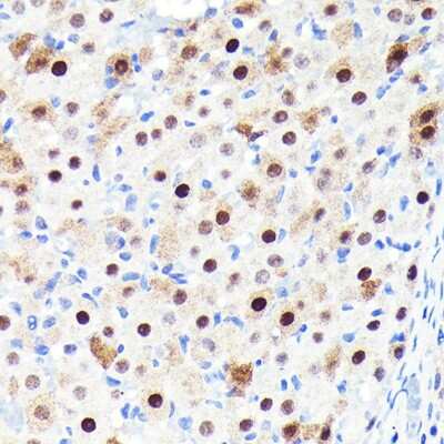 Immunohistochemistry-Paraffin: p27/Kip1 Antibody (9R5B4) [NBP3-15662]