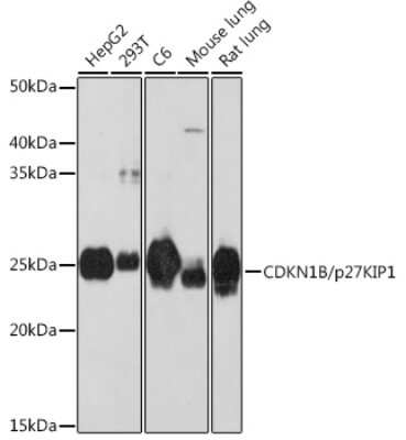 Western Blot: p27/Kip1 Antibody (9R5B4) [NBP3-15662]