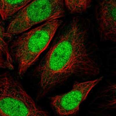 Immunocytochemistry/ Immunofluorescence: p27/Kip1 Antibody [NBP2-56105]