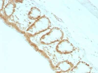 Immunohistochemistry-Paraffin: p27/Kip1 Antibody (KIP1/769) - Azide and BSA Free [NBP2-47769]