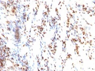 Immunohistochemistry-Paraffin: p27/Kip1 Antibody (KIP1/769) - IHC-Prediluted [NBP2-48399]