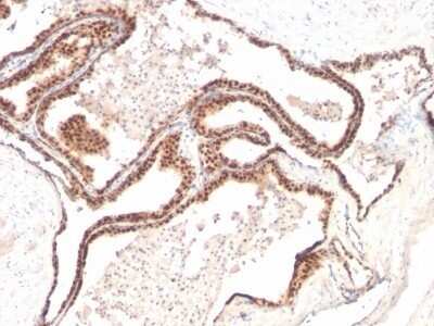 Immunohistochemistry-Paraffin: p27/Kip1 Antibody (KIP1/769) - IHC-Prediluted [NBP2-48399]
