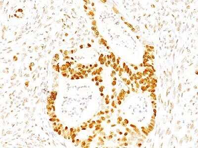 Immunohistochemistry-Paraffin: p27/Kip1 Antibody (SPM348) - Azide and BSA Free [NBP2-34766]