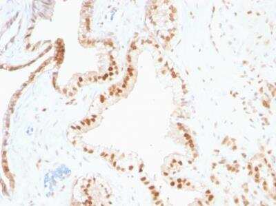 Immunohistochemistry-Paraffin: p27/Kip1 Antibody (SPM348) [NBP2-32890]
