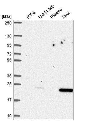 Western Blot: p27/Kip1 Antibody [NBP2-56105]
