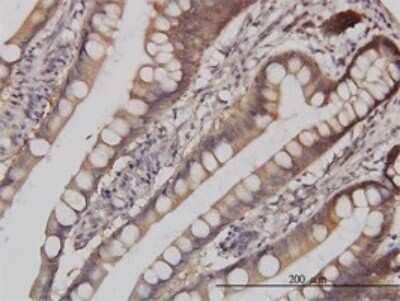 Immunohistochemistry-Paraffin: p38 delta/SAPK4 Antibody (2B2) [H00005603-M05]