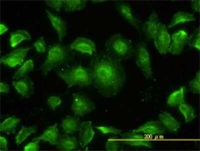 Immunocytochemistry/ Immunofluorescence: p38 delta/SAPK4 Antibody (2C10-1C7) [H00005603-M01]