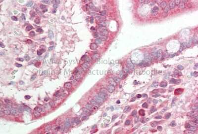 Immunohistochemistry: p38 delta/SAPK4 Antibody [NBP1-58256]