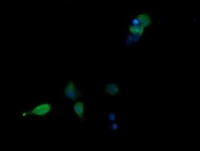 Immunocytochemistry/ Immunofluorescence: p38 delta/SAPK4 Antibody (OTI12B2) - Azide and BSA Free [NBP2-73188]