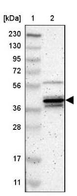 Western Blot: p38 delta/SAPK4 Antibody [NBP1-87373]