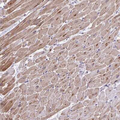 Immunohistochemistry-Paraffin: p38 gamma/SAPK3 Antibody [NBP2-38729]