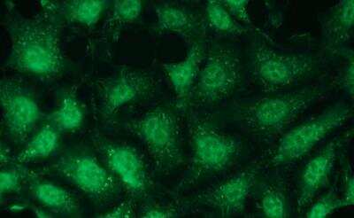 Immunocytochemistry/ Immunofluorescence: p38 gamma/SAPK3 Antibody (R13-L) [NBP3-08207]