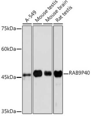 Western Blot: p40 Antibody (10E2A4) [NBP3-15815]