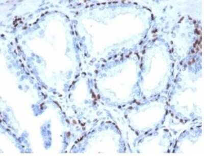 Immunohistochemistry-Paraffin: p40/deltaNp63 Antibody (P40/4396R) [NBP3-13805]