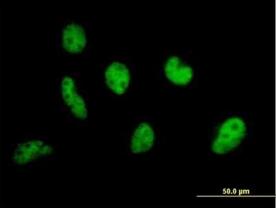 Immunocytochemistry/ Immunofluorescence: p400 Antibody [H00057634-B01P]