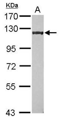 Western Blot: p400 Antibody [NBP2-19663]