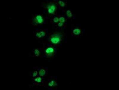 Immunocytochemistry/ Immunofluorescence: p53 Antibody (OTI5E2) [NBP2-00723]
