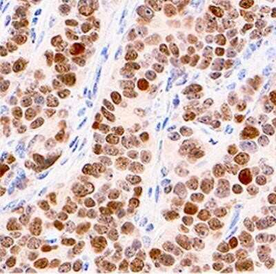 Immunohistochemistry-Paraffin: p53 Antibody (BP53-12) - Azide and BSA Free [NBP2-33074]