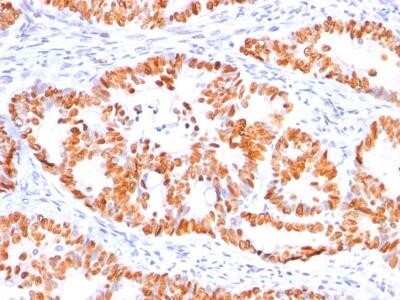 Immunohistochemistry-Paraffin: p53 Antibody (BP53-12) - Azide and BSA Free [NBP2-33074]