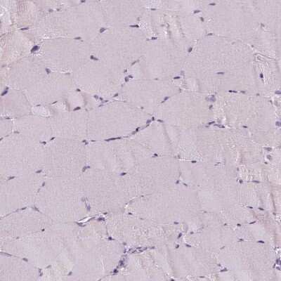 Immunohistochemistry-Paraffin: p53 Antibody (CL2199) [NBP2-34495]