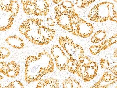 Immunohistochemistry-Paraffin: p53 Antibody (DO-7) - Azide and BSA Free [NBP2-34605]