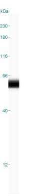 Simple Western: p53 Antibody (DO-7) [NBP2-34308]