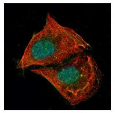 Immunocytochemistry/ Immunofluorescence: p53 Antibody [NBP2-19667]