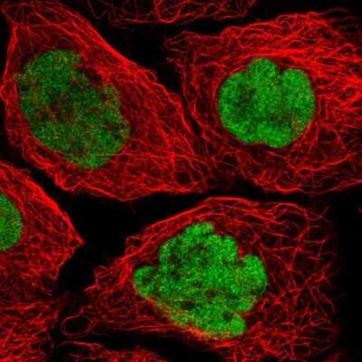 Immunocytochemistry/ Immunofluorescence: p53 Antibody [NBP2-56234]