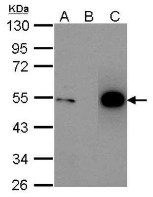 Immunoprecipitation: p53 Antibody [NBP2-19667]