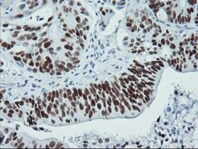 Immunohistochemistry: p53 Antibody (OTI5E2) - Azide and BSA Free [NBP2-73200]