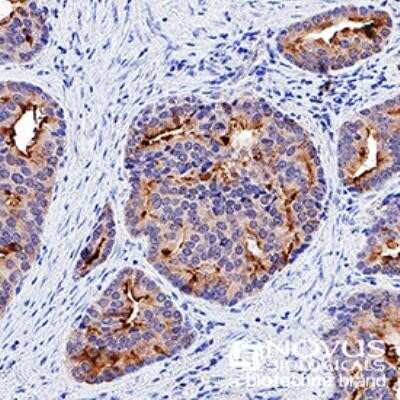 Immunohistochemistry: p53 Antibody (PAb 240) - Azide and BSA Free [NBP2-80898]