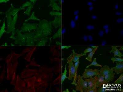 Immunocytochemistry/ Immunofluorescence: p53 Antibody (PAb 240) - BSA Free [NB200-103]