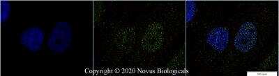 Immunocytochemistry/ Immunofluorescence: p53 Antibody (PAb 240) - BSA Free [NB200-103]