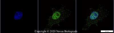 Immunocytochemistry/ Immunofluorescence: p53 Antibody (PAb 240) - BSA Free [NB200-103]