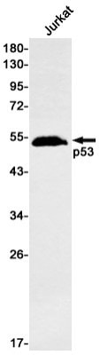 Western Blot: p53 Antibody (S07-6A7) [NBP3-20045]