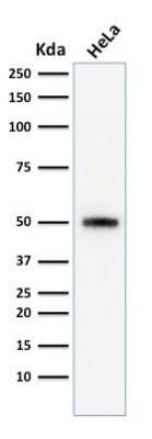Western Blot: p53 Antibody (SPM590) [NBP2-34387]