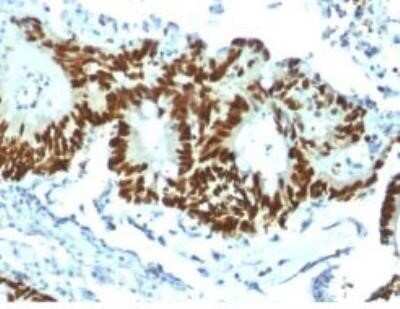 Immunohistochemistry-Paraffin: p53 Antibody (TP53/1799R) - Azide and BSA Free [NBP2-59632]