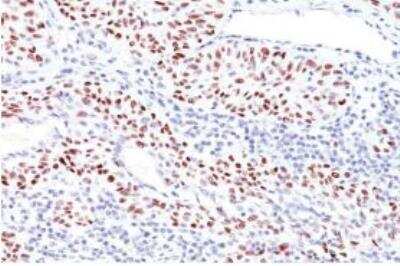 Immunohistochemistry-Paraffin: p53 Antibody (TRP/816) [NBP2-59626]