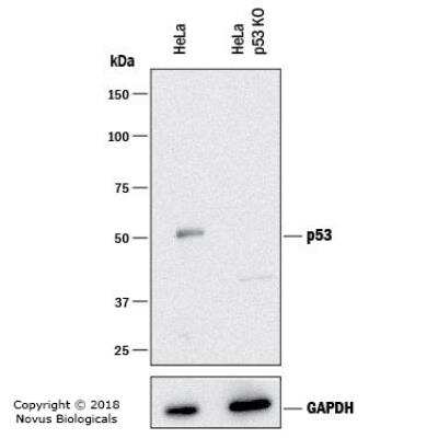 Knockout Validated: p53 Antibody (TRP/816) [NBP2-59626]