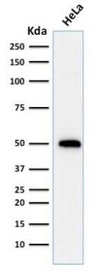 Western Blot: p53 Antibody (TRP/816) [NBP2-59626]
