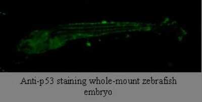 Immunohistochemistry: p53 Antibody (V5P4H6*B3) - BSA Free [NBP2-50231]