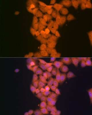 Immunocytochemistry/ Immunofluorescence: p53 DINP1 Antibody (9Y6Z7) [NBP3-16620]