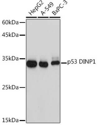 Western Blot: p53 DINP1 Antibody (9Y6Z7) [NBP3-16620]