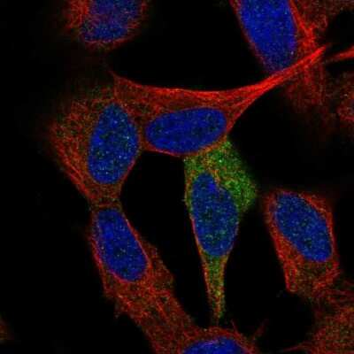 Immunocytochemistry/ Immunofluorescence: p53 DINP1 Antibody [NBP1-85108]